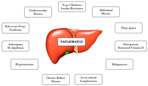 Nafld And Metabolic Syndrome - Captions Trendy