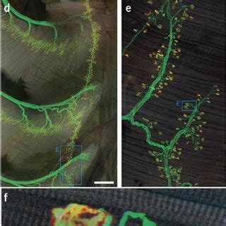 Innervation pattern of the triangularis sterni muscle.(a–c ...