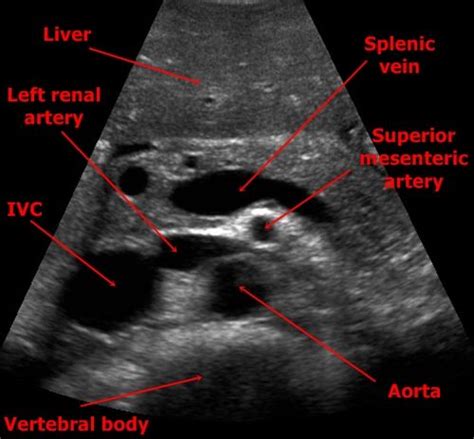 Medical ultrasound, Ultrasound technician, Ultrasound physics