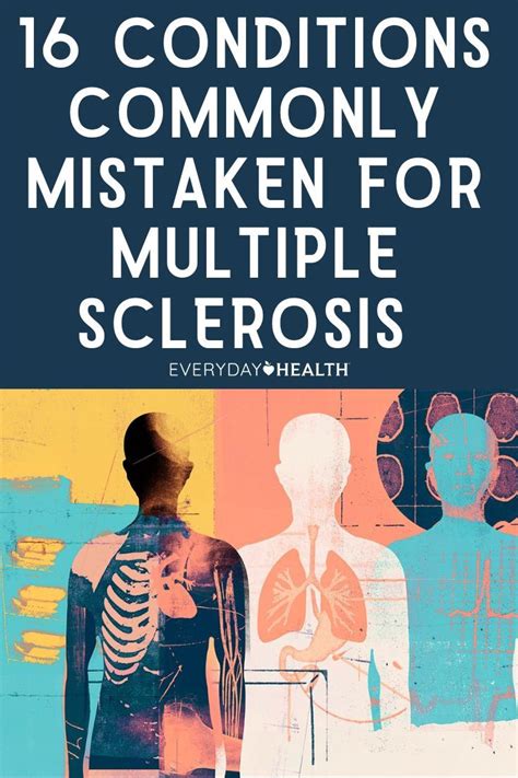 16 Conditions That May Be Mistaken for Multiple Sclerosis in 2024 ...