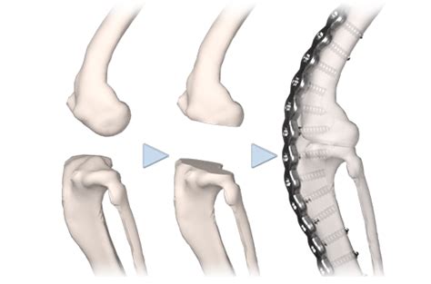 Arthrodesis guide