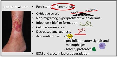 IJMS | Free Full-Text | Chronic Inflammation in Non-Healing Skin Wounds ...