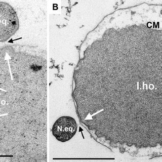 Epifluorescence microphotographs of the coculture at different growth... | Download Scientific ...