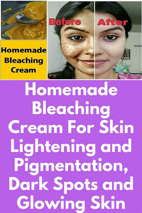 Homemade Bleaching Cream For Skin Lightening and Pigmentation, Dark Spots and Glowing Skin Today ...