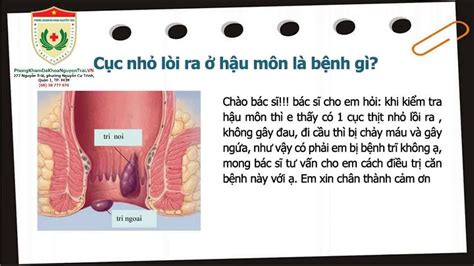 Dấu Hiệu Của Bệnh Trĩ Và Cách Điều Trị Hiệu Quả