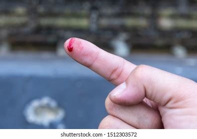 Cut Finger Bleeding Finger Stock Photo 1512303572 | Shutterstock