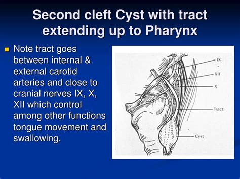 PPT - Branchial Cleft Cyst PowerPoint Presentation - ID:261469