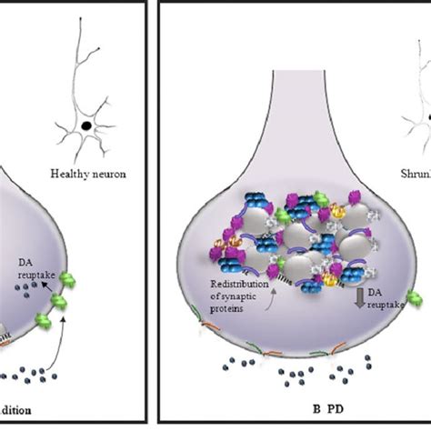 (PDF) Parkinson's disease: From synaptic loss to connectome dysfunction