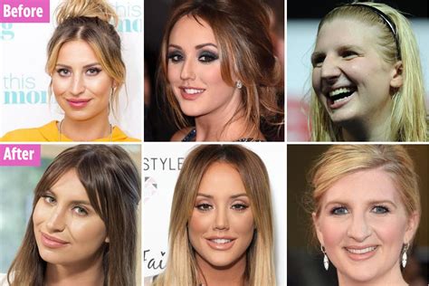 The best and worst celebrity nose jobs, from Ferne McCann to Rebecca Adlington and La Toya ...