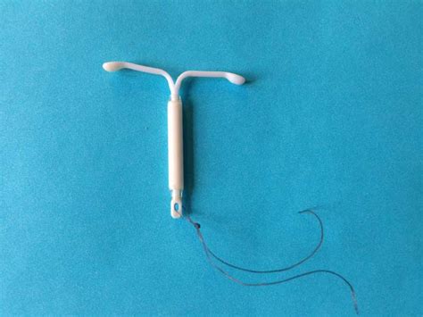 Mirena IUD Linked to Intracranial Hypertension and Vision Issues