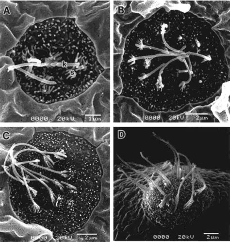 Scanning electron micrographs showing ordinary superficial neuromasts... | Download Scientific ...