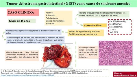 Tumor del estroma gastrointestinal GIST caso clinico | Med_byme | uDocz