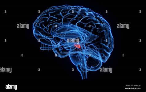 Subthalamic Nucleus Anatomy