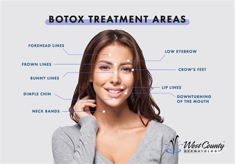 BOTOX ® Treatment Chesterfield, MO - West County Dermatology