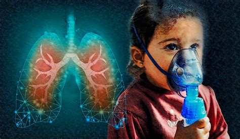 Possible Driver of Cystic Fibrosis Lung Inflammation (Monocytes) Yields ...