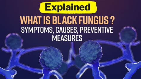 Understanding Black Fungus is more important than Succumbing to its ...