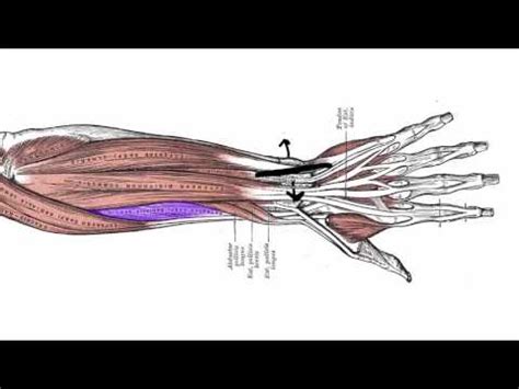 Wrist Tendonitis Surgery - What, Why, and Should You? - YouTube