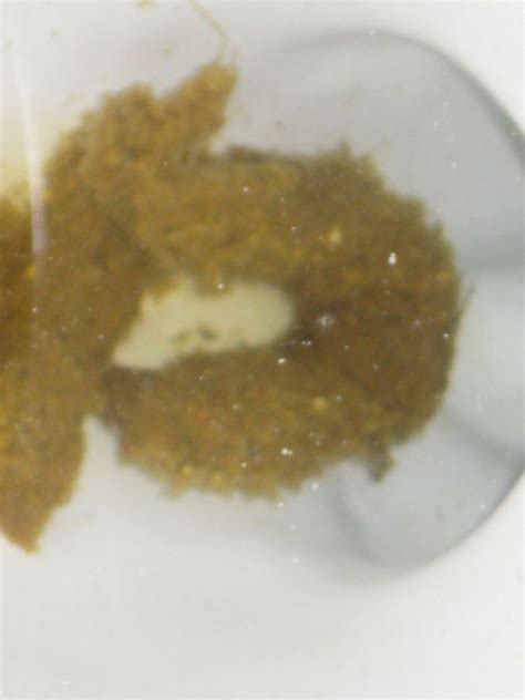 What are these white segments this in my bowel movement? (WARNING PICTURE LINK) at Candida ...