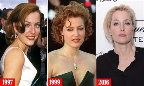 Gillian Anderson Plastic Surgery: Before and After | PlasticSurgeryInsights.com