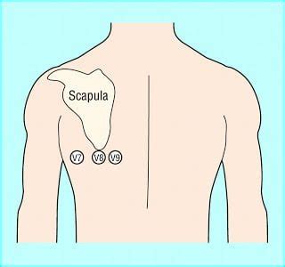 Paucis Verbis: Right and posterior EKG leads