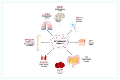 Autoimmune Diseases: Types, Symptoms, Causes, & Treatment