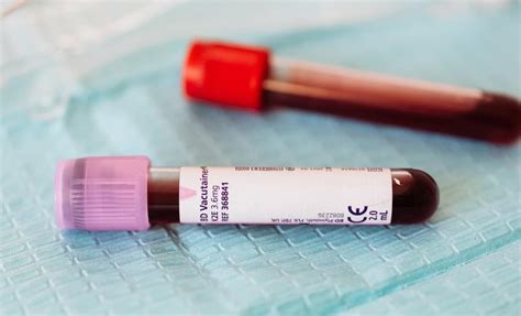 Recommended Annual Blood Tests Your Doctor Should Be Ordering