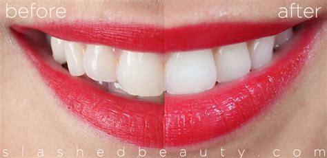 REVIEW with Before & After: Crest 3D White Whitestrips | Slashed Beauty