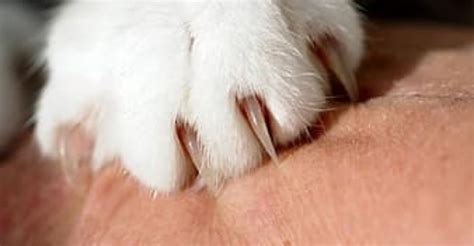 Cat Scratch Disease: A 7-Step Brief Guide