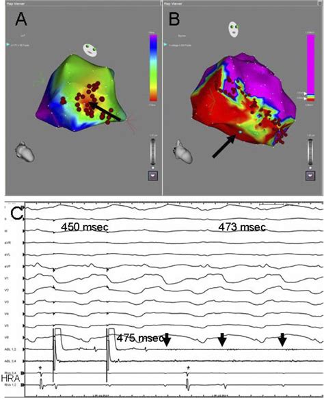 Illustrative case study of a patient with ischemic cardiomyopathy,... | Download Scientific Diagram