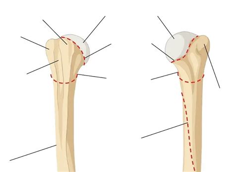 Osteology of the Proximal Upper Limb - Bony Landmarks of the humerus ...