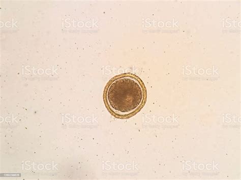 Toxocara Cati Egg Under The Microscope Stock Photo - Download Image Now - Helminthiasis ...