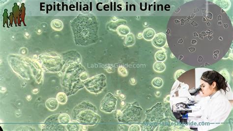 What Are Epithelial Cells In Urine And Its Normal Range?, 49% OFF