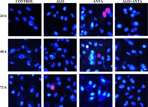 Fluorescence microscopy findings after Hoechst 33342 staining in PC-3... | Download Scientific ...