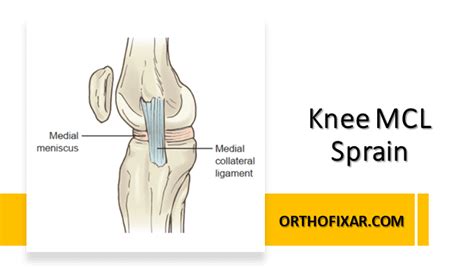 Orthopedic Sports Medicine 2023 | OrthoFixar