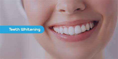 Teeth Whitening In Turkey – International Medical Expert