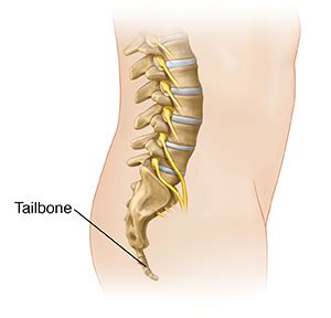 Tailbone (Coccyx) Fracture - Sterling Care - In-Home Care Westchester ...