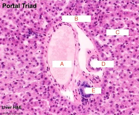 Histology Of Liver Labeled