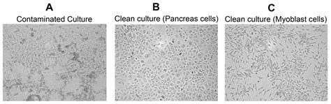 Bacterial Contamination Cell Culture