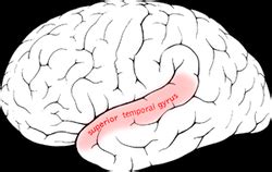 Superior temporal gyrus - Location, Function and Pictures