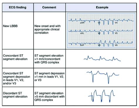 Electrocardiographic (ECG) indications for reperfusion therapy in the ...