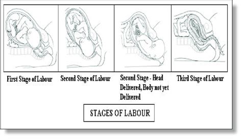 Stages of labour. | Download Scientific Diagram