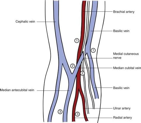 Basilic and Femoral Vein Transposition - Clinical Tree