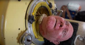 Paul Alexander: The Man Living Inside an Iron Lung for 70 Years