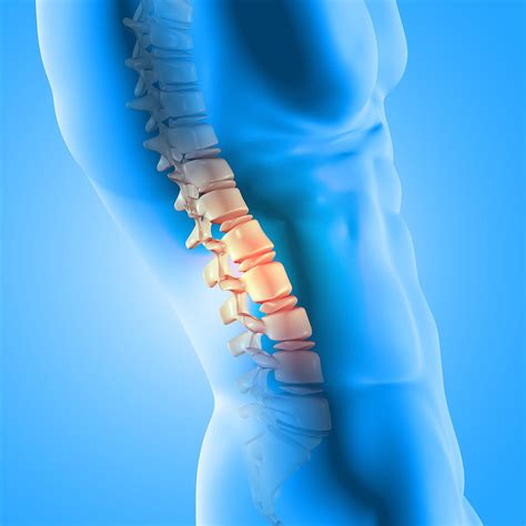 Degenerative Disc Disease Treatment in Fairfax, VA and Potomac, MD ...