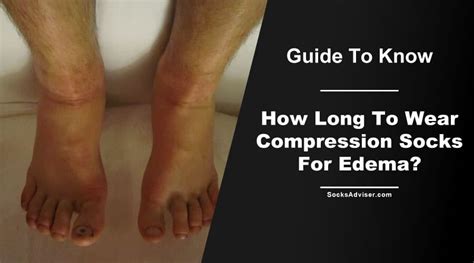 How Long To Wear Compression Socks For Edema? - Socks Adviser