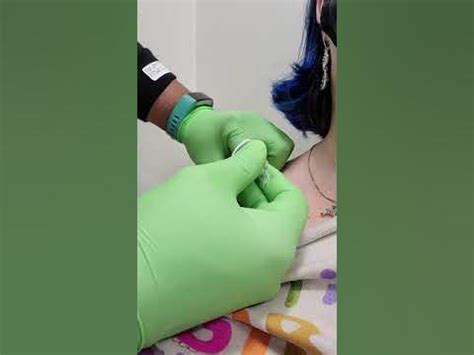 Portacath needle insertion, first time - YouTube