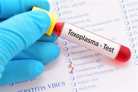 Understanding Toxoplasmosis: Symptoms, Causes and Diagnosis and Treatment Options - Apollo ...