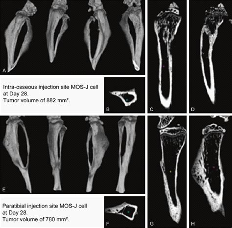 Bone micro-architecture analysis by micro-CT on Day 28 after tumor cell... | Download Scientific ...