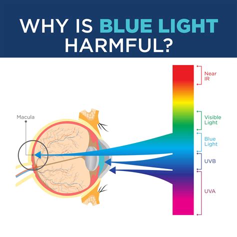 Ipad Blue Light Macular Degeneration | Shelly Lighting