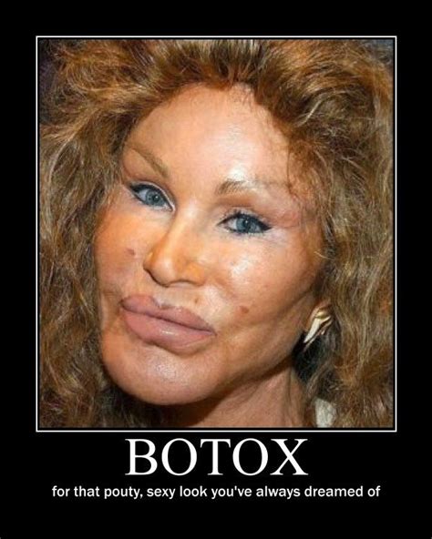 20 Hilarious Botox Memes That Show What Happens When It Kicks In ...